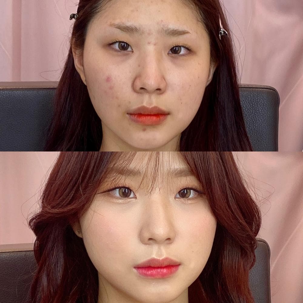 P2P 썸네일 이미지