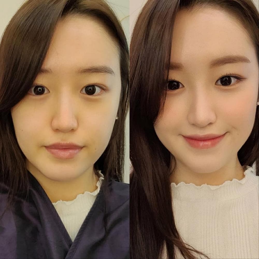 P2P 썸네일 이미지