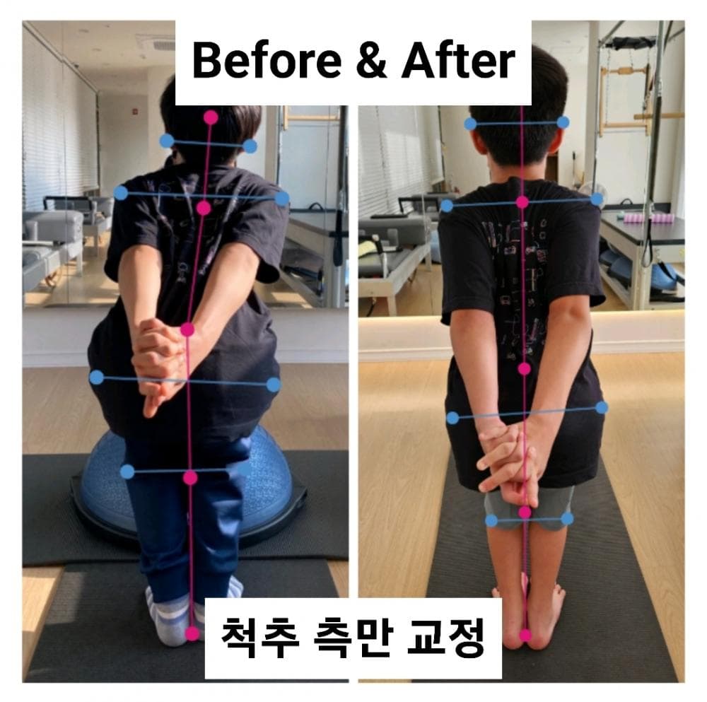 P2P 썸네일 이미지