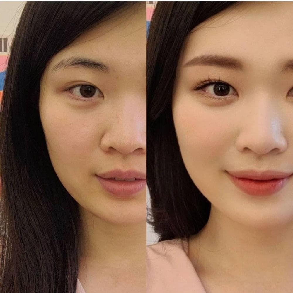 P2P 썸네일 이미지