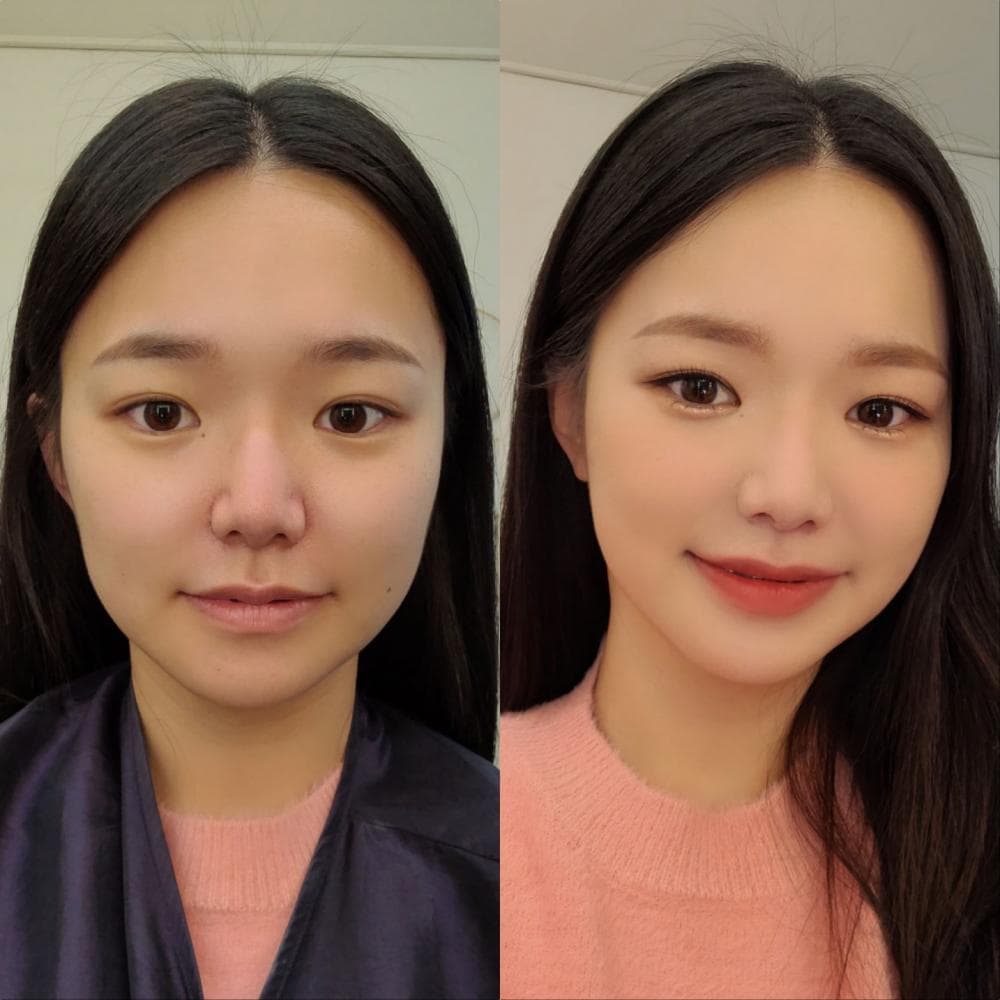 P2P 썸네일 이미지