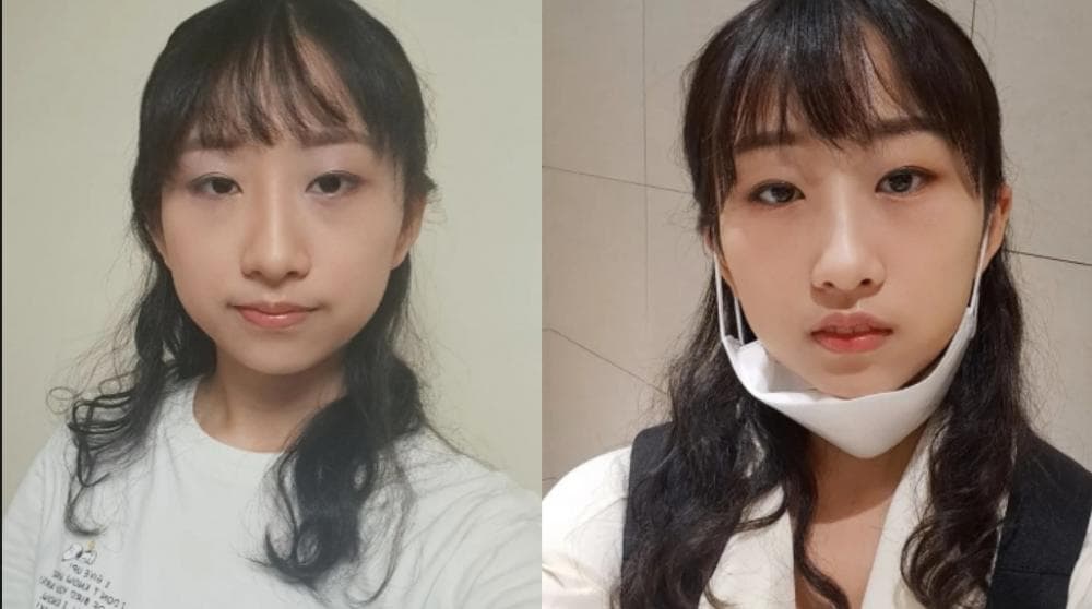 P2P 썸네일 이미지