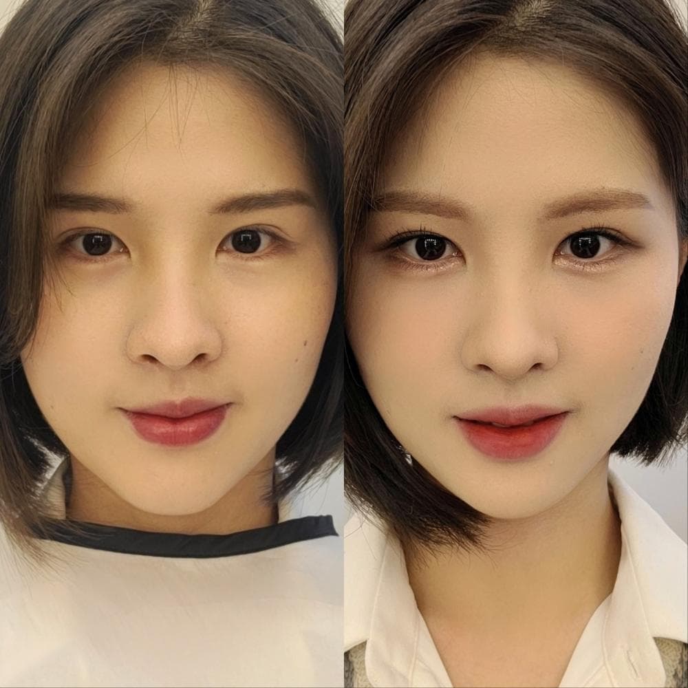 P2P 썸네일 이미지