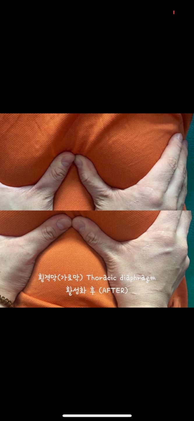 P2P 썸네일 이미지