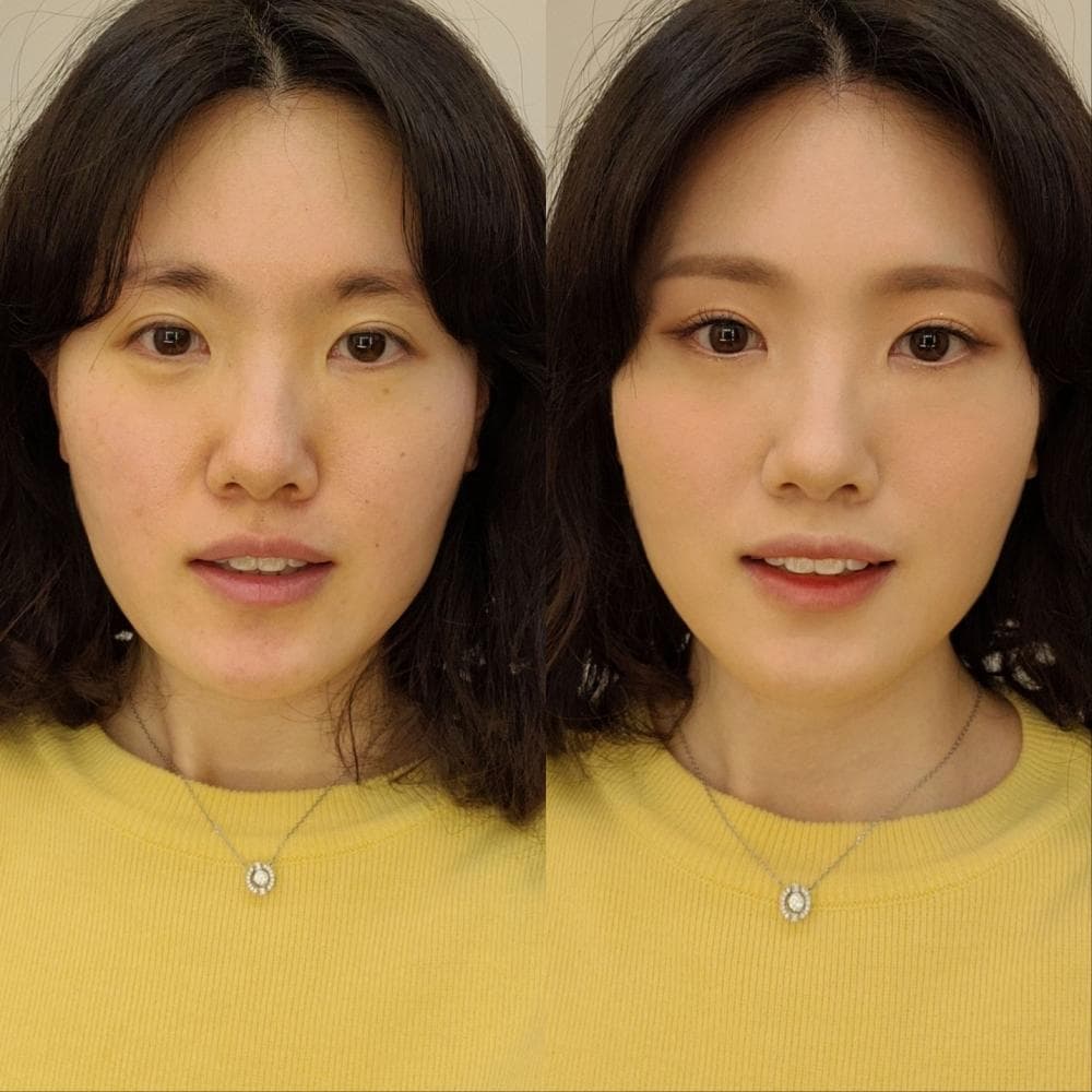 P2P 썸네일 이미지