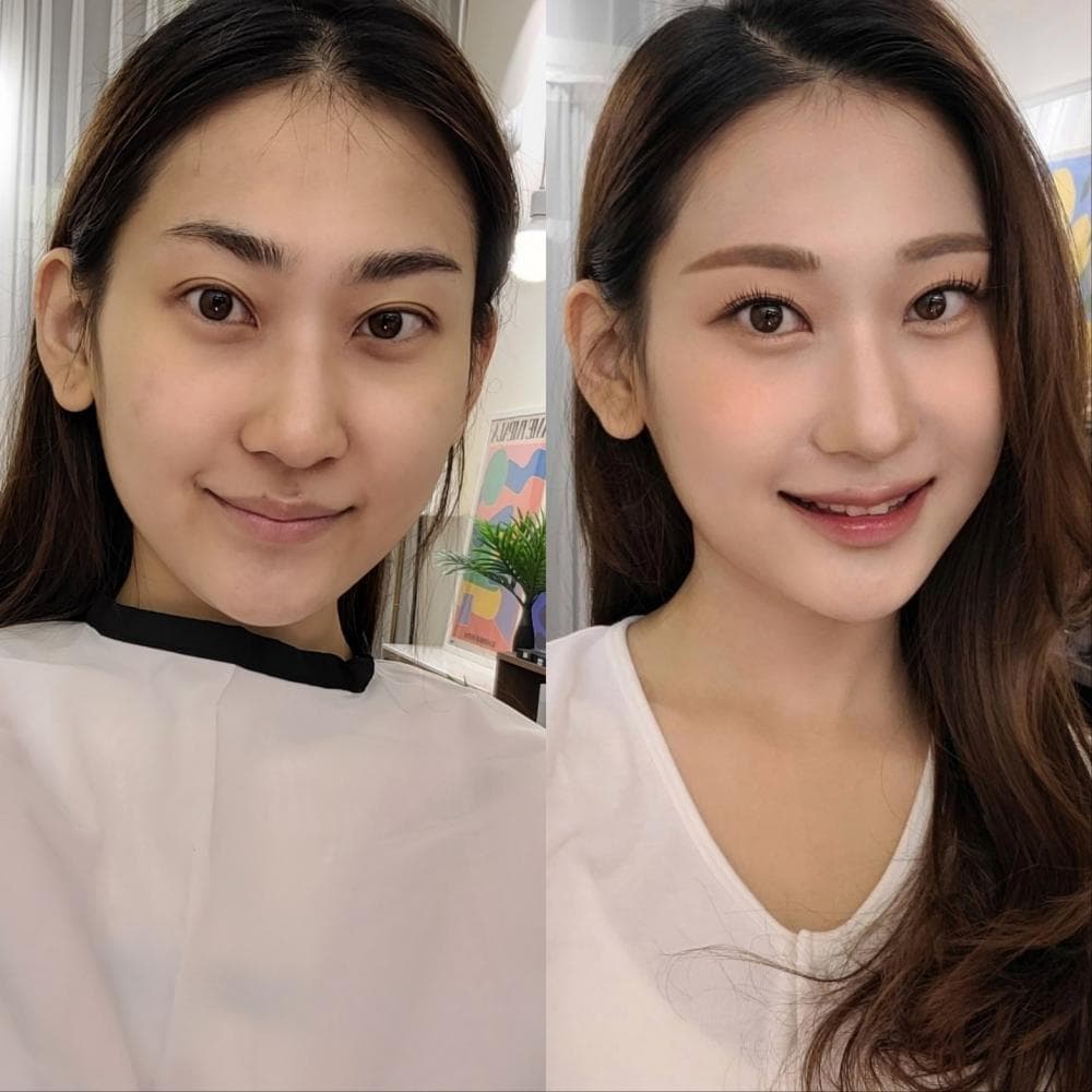 P2P 썸네일 이미지